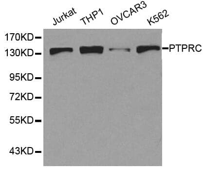 Anti-PTPRC Antibody