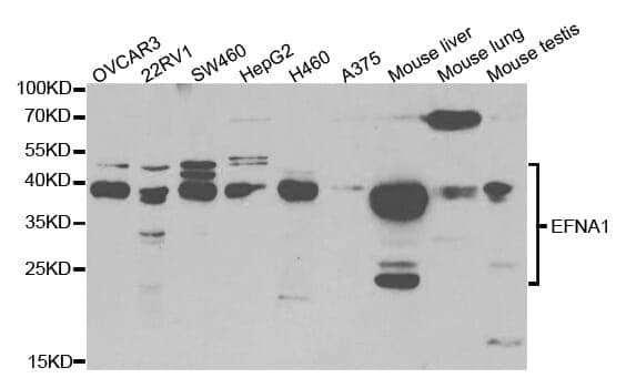 Anti-EFNA1 Antibody