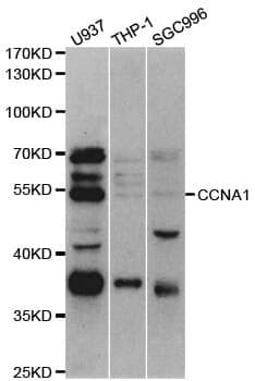 Anti-CCNA1 Antibody