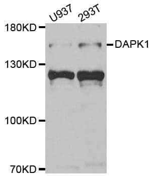 Anti-DAPK1 Antibody
