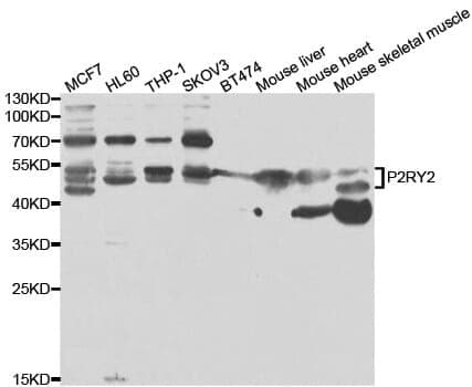 Anti-P2RY2 Antibody