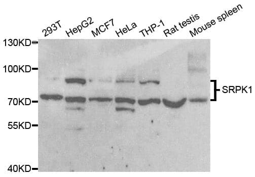 Anti-SRPK1 Antibody