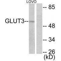 Anti-GLUT3 Antibody