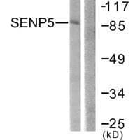 Anti-SENP5 Antibody