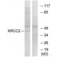 Anti-XRCC2 Antibody