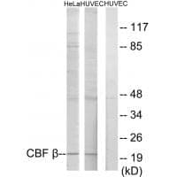 Anti-CBF β Antibody