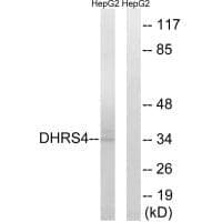 Anti-DHRS4 Antibody