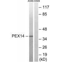 Anti-PEX14 Antibody