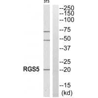 Anti-RGS5 Antibody