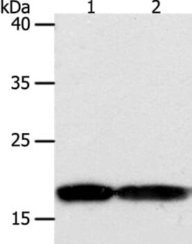 Anti-PDCD6 Antibody