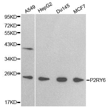 Anti-P2RY6 Antibody