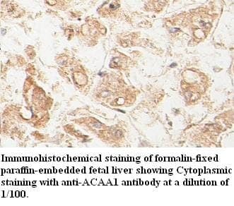 Anti-ACAA1 Antibody