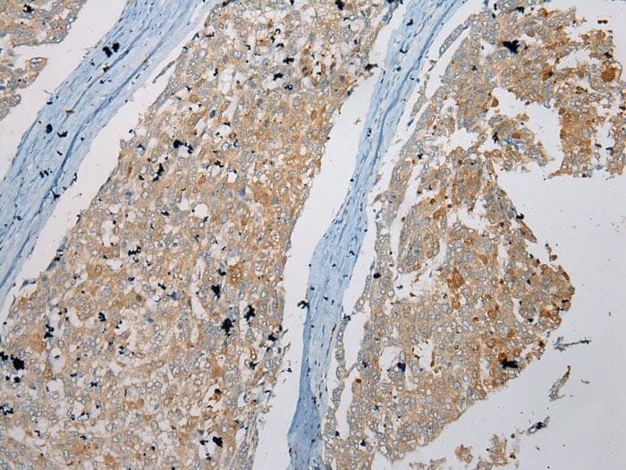 Anti-NUDT6 Antibody