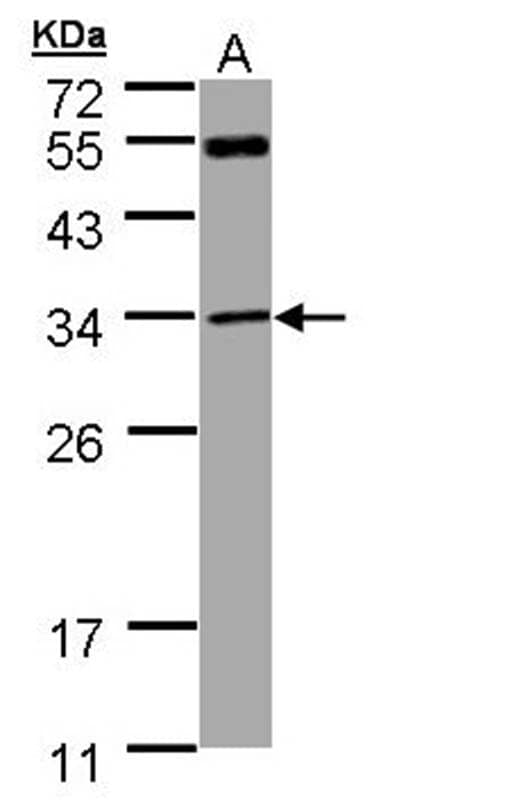 Anti-MTAP Antibody