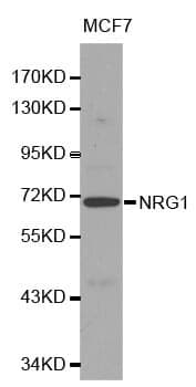 Anti-NRG1 Antibody