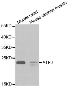 Anti-ATF3 Antibody