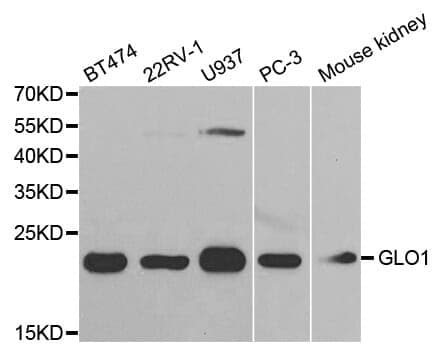 Anti-GLO1 Antibody
