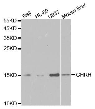 Anti-GHRH Antibody