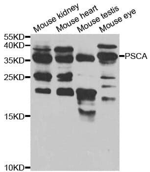 Anti-PSCA Antibody