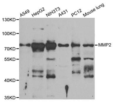 Anti-MMP2 Antibody
