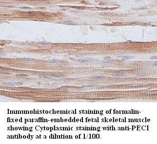 Anti-PECI Antibody