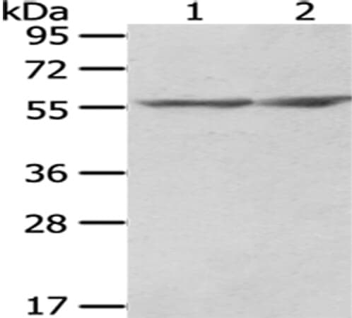 Anti-CCT2 Antibody