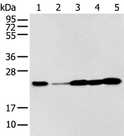 Anti-BAG2 Antibody