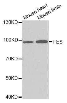 Anti-FES Antibody