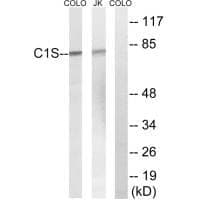 Anti-C1S Antibody