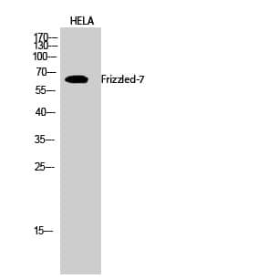 Anti-Frizzled-7 Antibody