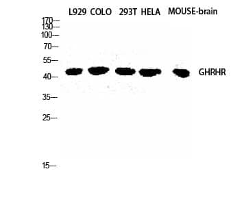 Anti-GHRH-R Antibody