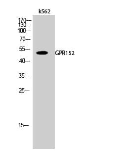 Anti-GPR152 Antibody