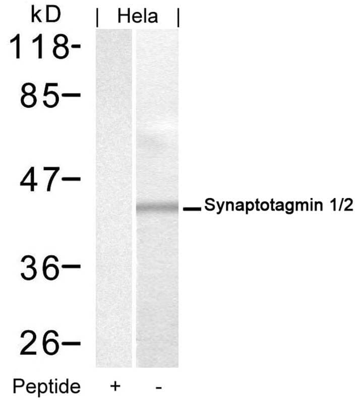 Anti-Synaptotagmin 1 / 2 (Ab-202 / 199) Antibody