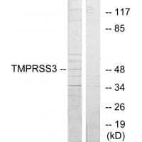 Anti-TMPRSS3 Antibody