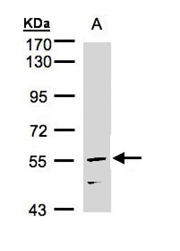 Anti-CDCA1 Antibody