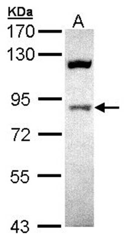 Anti-ACAP1 Antibody