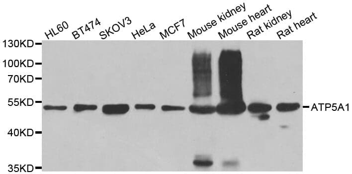 Anti-ATP5A1 Antibody
