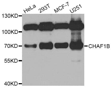 Anti-CHAF1B Antibody
