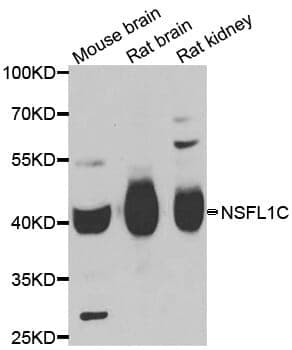 Anti-NSFL1C Antibody