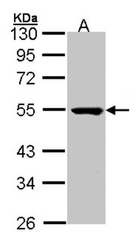 Anti-PSKH1 Antibody