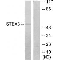Anti-STEA3 Antibody