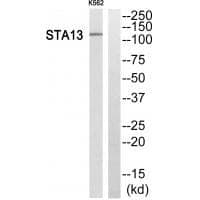 Anti-STA13 Antibody