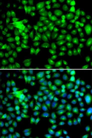 Anti-HSPB8 Antibody