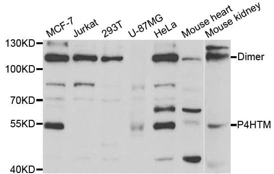 Anti-P4HTM Antibody