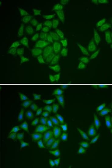 Anti-AMPD3 Antibody