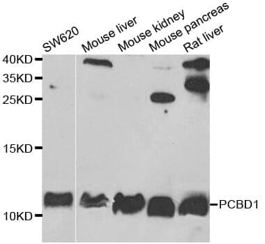 Anti-PCBD1 Antibody
