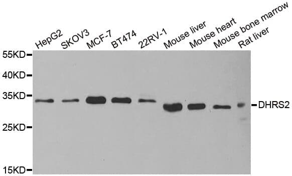 Anti-DHRS2 Antibody