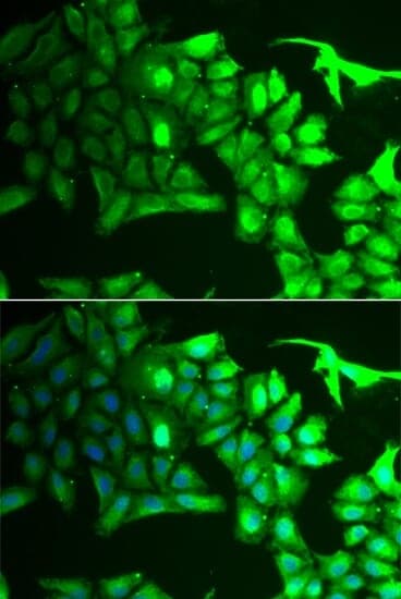 Anti-AIPL1 Antibody