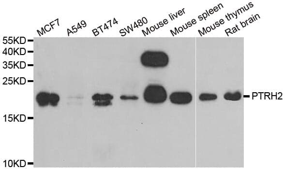 Anti-PTRH2 Antibody