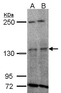 Anti-TYK2 Antibody
